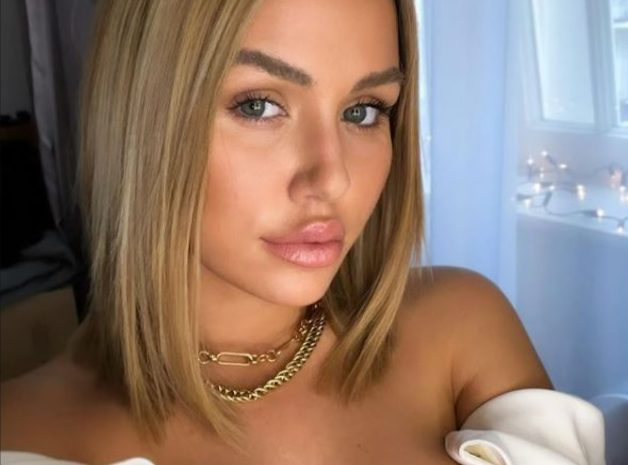 Hirntumor bei beliebter Dschungelcamp-Kandidatin - Kim Gloss musste operiert werden